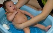 Chớ chủ quan khi trẻ hẹp bao quy đầu Chớ chủ quan khi trẻ hẹp bao quy đầu