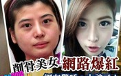 Cô nàng mặt tròn thành "hot girl" sau khi gọt mặt gây sốt Cô nàng mặt tròn thành "hot girl" sau khi gọt mặt gây sốt