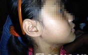 Rợn người nghe bé gái kể bị bố và dì ghẻ đánh, vứt ra nghĩa địa Rợn người nghe bé gái kể bị bố và dì ghẻ đánh, vứt ra nghĩa địa