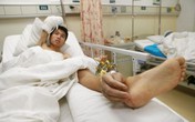 Chàng trai có bàn tay phải "mọc" ở chân Chàng trai có bàn tay phải "mọc" ở chân