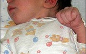 Những em bé có hai bộ phận sinh dục Những em bé có hai bộ phận sinh dục