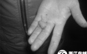Giở trò đồi bại, "yêu râu xanh" bị... cắn đứt lưỡi Giở trò đồi bại, "yêu râu xanh" bị... cắn đứt lưỡi