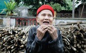 Hà Nội: Cụ ông 90 tuổi mọc lại cả hàm răng Hà Nội: Cụ ông 90 tuổi mọc lại cả hàm răng