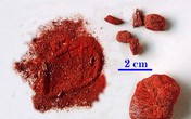 Bé trai 7 tháng bị ngộ độc thần sa Bé trai 7 tháng bị ngộ độc thần sa