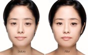 Cách trang điểm đơn giản che khuyết điểm mắt sụp mí Cách trang điểm đơn giản che khuyết điểm mắt sụp mí