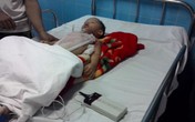 Bé 2 tuổi bỏng nặng do ca nước của mẹ Bé 2 tuổi bỏng nặng do ca nước của mẹ