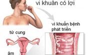 Những bệnh gây ra mùi khó chịu ở "vùng kín" Những bệnh gây ra mùi khó chịu ở "vùng kín"