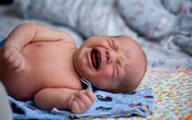 Sinh con xấu, chồng nghi vợ ngoại tình Sinh con xấu, chồng nghi vợ ngoại tình