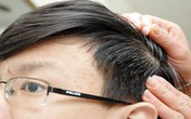 Món ăn bài thuốc chữa chứng tóc bạc sớm Món ăn bài thuốc chữa chứng tóc bạc sớm