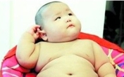 Bé trai "khổng lồ" 8 tháng tuổi nặng hơn 17,5kg Bé trai "khổng lồ" 8 tháng tuổi nặng hơn 17,5kg