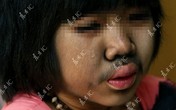 Đáng thương bé gái 9 tuổi bị mọc lông khắp cơ thể Đáng thương bé gái 9 tuổi bị mọc lông khắp cơ thể