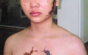Những bất thường trong vụ án thiếu nữ bị xăm rết lên mặt Những bất thường trong vụ án thiếu nữ bị xăm rết lên mặt