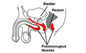 Bài tập Kegel giúp "chuyện ấy" thăng hoa Bài tập Kegel giúp "chuyện ấy" thăng hoa