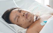 Bắt ong kiếm tiền mua sách cho con, bị ong đốt nguy kịch Bắt ong kiếm tiền mua sách cho con, bị ong đốt nguy kịch