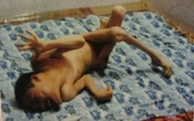 Triển lãm “Da cam – Lương tri và Công lý” Triển lãm “Da cam – Lương tri và Công lý”