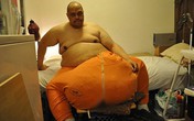 Người đàn ông có "của quý" nặng nhất thế giới được phẫu thuật thành công