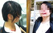 “Chung cư “ông Thản” lại gây bất bình dư luận”: Chơi “luật rừng” ngay giữa Thủ đô? “Chung cư “ông Thản” lại gây bất bình dư luận”: Chơi “luật rừng” ngay giữa Thủ đô?