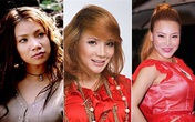 Những thảm họa thẩm mỹ đau lòng trong showbiz Những thảm họa thẩm mỹ đau lòng trong showbiz