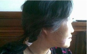 Hãi hùng một phụ nữ bị chó hàng xóm cắn nát mặt Hãi hùng một phụ nữ bị chó hàng xóm cắn nát mặt