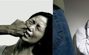 Đớn đau mất khả năng làm mẹ vì bị chồng đánh Đớn đau mất khả năng làm mẹ vì bị chồng đánh