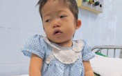 Bé 3 tuổi từng bị bỏ rơi tím tái không thể phẫu thuật được Bé 3 tuổi từng bị bỏ rơi tím tái không thể phẫu thuật được