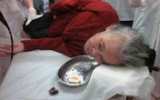 Vỡ thực quản vì nhịn... nôn Vỡ thực quản vì nhịn... nôn