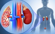 Dinh dưỡng cho người bệnh suy thận: Ăn đúng cách giúp làm chậm tiến triển bệnh