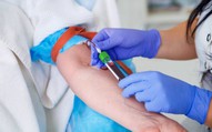 PGS Nguyễn Lân Hiếu cảnh báo: Một sai số nhỏ khi xét nghiệm máu tại nhà cũng có thể khiến người bệnh tưởng suy thận, ung thư