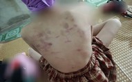 Vụ nữ sinh lớp 4 ở Cao Bằng bị đánh: Người mẹ dân tộc Nùng học hết lớp 7 mong con được bảo vệ