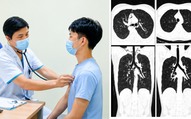 Nam thanh niên 20 tuổi tràn khí trung thất sau 1 tuần ho liên tục, bác sĩ cảnh báo dấu hiệu dễ bị bỏ qua