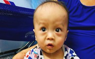 Cuộc sống khốn khó của em bé cai được máy ôxy lại phát hiện mắc não úng thủy