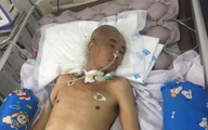 Hai con nguy cơ nghỉ học giữa chừng vì bố nguy kịch sau xuất huyết não