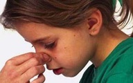 Chảy máu cam mà ngửa đầu ra sẽ viêm phổi?