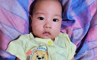 Bé trai bị teo thực quản đã được phẫu thuật, sức khỏe tốt lên