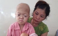 Xót xa bé gái tàn tật lại mắc bệnh ung thư