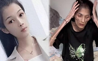 Bệnh gì khiến người phụ nữ 27 tuổi cao 1,6m nhưng chỉ nặng 17,5kg bị "teo dạ dày" và qua đời: BS khuyến cáo loại vi khuẩn có liên quan