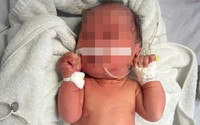 Hà Nội: Bé gái sơ sinh bị bỏ rơi ở bụi chuối, trên người nhiều vết xước và côn trùng đốt