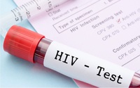Đi khám vì đau họng dai dẳng, mảng trắng lan nhanh trong miệng, cô gái bất ngờ phát hiện HIV