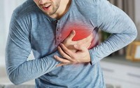 Người đàn ông 40 tuổi đang khỏe mạnh bất ngờ đột quỵ từ dấu hiệu nhiều người Việt bỏ qua