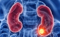 Người đàn ông suy thận giai đoạn 3 ân hận vì tự ý làm điều này khiến bệnh trầm trọng hơn