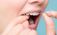 Những ai đang dùng chỉ nha khoa cần đặc biệt lưu ý điều này