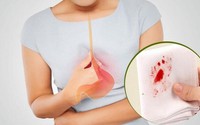 Người phụ nữ 63 tuổi phát hiện ung thư dạ dày từ dấu hiệu nhiều người Việt thường bỏ qua