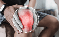 Không phải leo cầu thang, đây mới là 3 thói quen âm thầm 'bào mòn' đầu gối sau tuổi 50