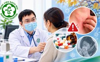 Đừng chủ quan với dị ứng thuốc khi giao mùa: Có thể nguy hiểm nếu dùng thuốc tùy ý