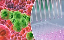 Tế bào ung thư sợ gì nhất?: Phát hiện nhiều 'điểm yếu' để loại bỏ tế bào ung thư