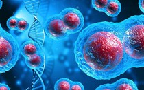 Tế bào ung thư hình thành như thế nào? Cơ thể cần gì để chống lại sự phát triển của chúng?