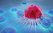 Thói quen âm thầm 'nuôi lớn' tế bào ung thư, nhiều người Việt đang mắc phải