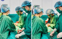 Cứu sống hai mẹ con sản phụ 35 tuần gặp biến chứng rau bong non, suy thai cấp đe dọa tính mạng