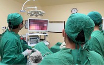 Đau bụng kéo dài, người phụ nữ 63 tuổi đi khám phát hiện dị vật quen thuộc trong bữa cơm