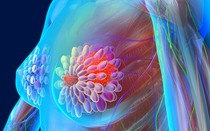 Người phụ nữ 41 tuổi phát hiện ung thư vú thừa nhận 1 sai lầm nhiều chị em Việt mắc phải